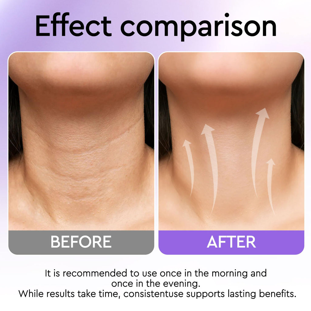 ORLASKIN Neck Firming Cream with Retinol – Tighten, Hydrate & Lift Face & Neck