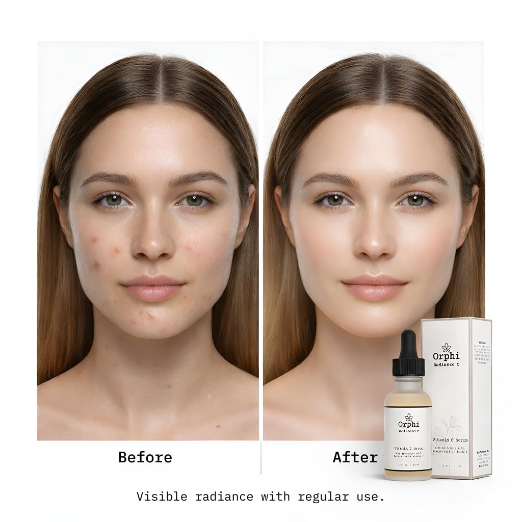 Orphi Radiance C Serum – Fragrance-Free Vitamin C with Hyaluronic Acid | USA Made