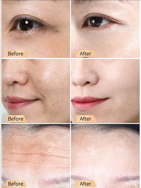 OSFRIAGE Snail Collagen Cream – Anti-Wrinkle & Rejuvenating Moisturizer for Women (2PCS)