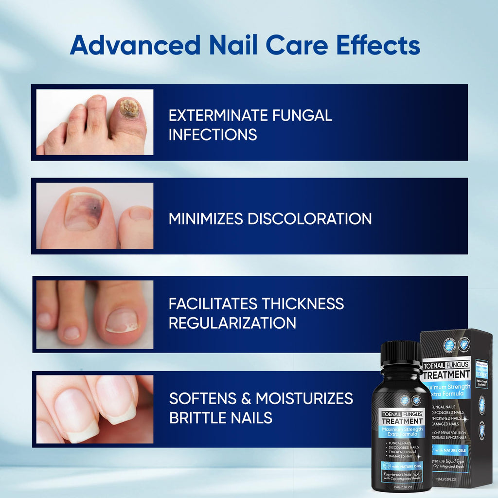 OSIMOON Fungus Treatment for Toenails – Extra Strength, Fast Acting, 2-Pack