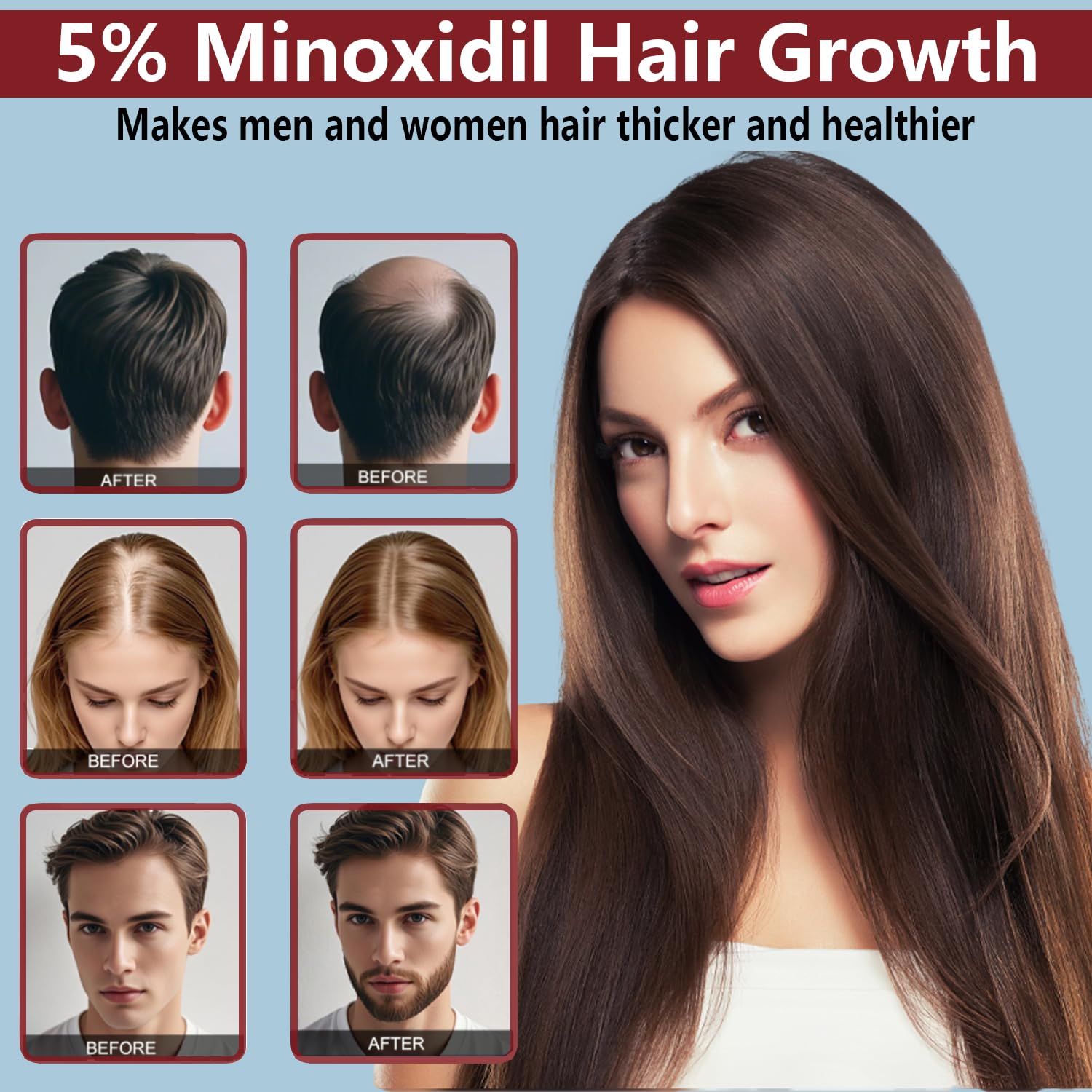 OURMUST 5% Minoxidil Hair Growth Cream – Extra Strength for Men & Women, 2 Bottles
