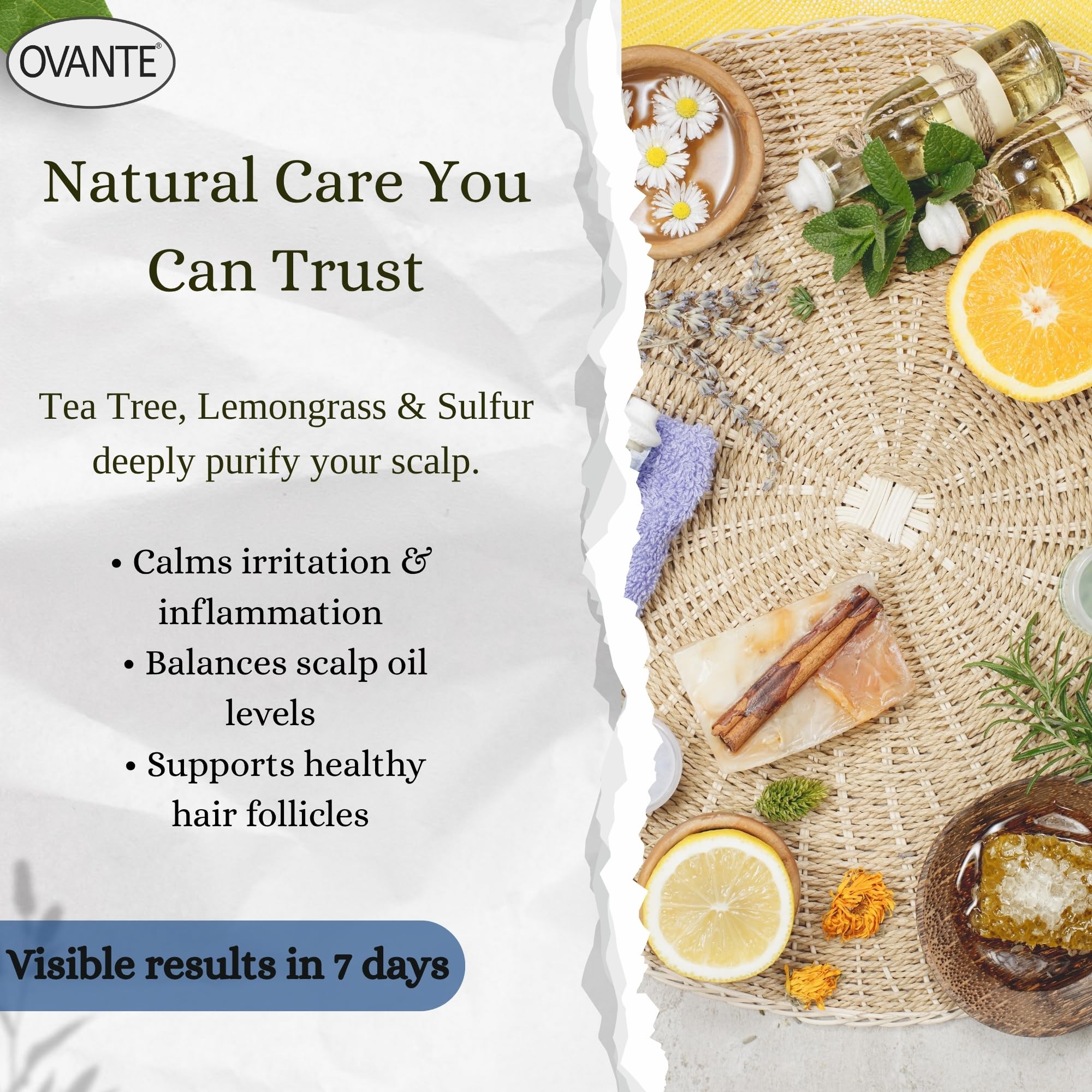 OVANTE Folliculitis Shampoo – Tea Tree Scalp Cleanser (6 oz)