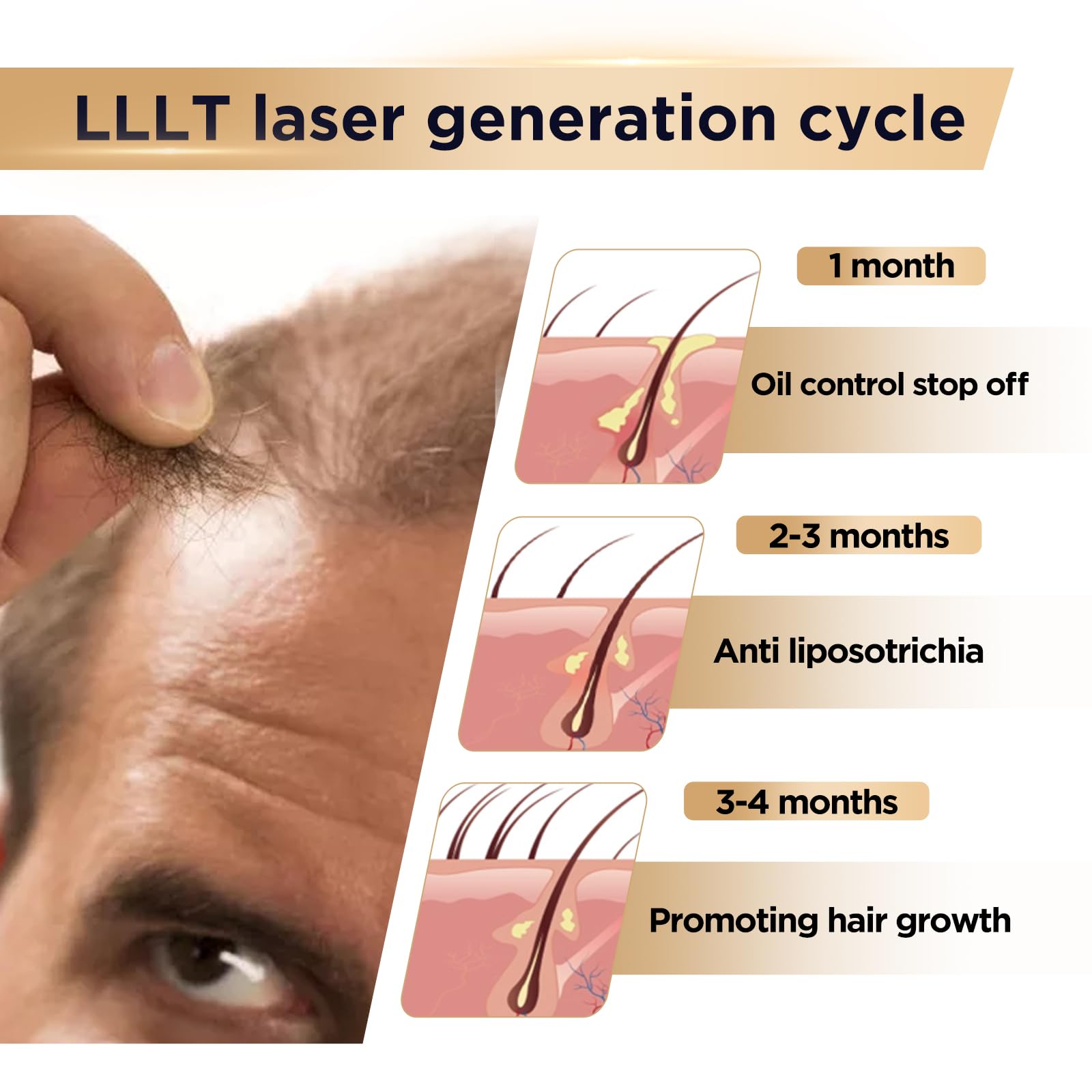 OVEKPA Red Light Therapy Hair Growth Device – FDA Cleared Laser Cap for Hair Regrowth