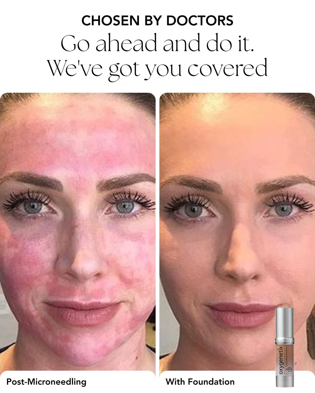 Oxygenetix Oxygenating Foundation Coco | Breathable, Buildable Coverage for Sensitive Skin