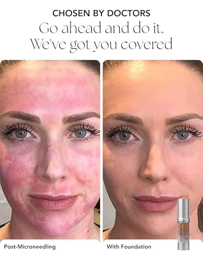 Oxygenetix Oxygenating Foundation – Porcelain | Breathable, Buildable Coverage for Sensitive or Post-Treatment Skin