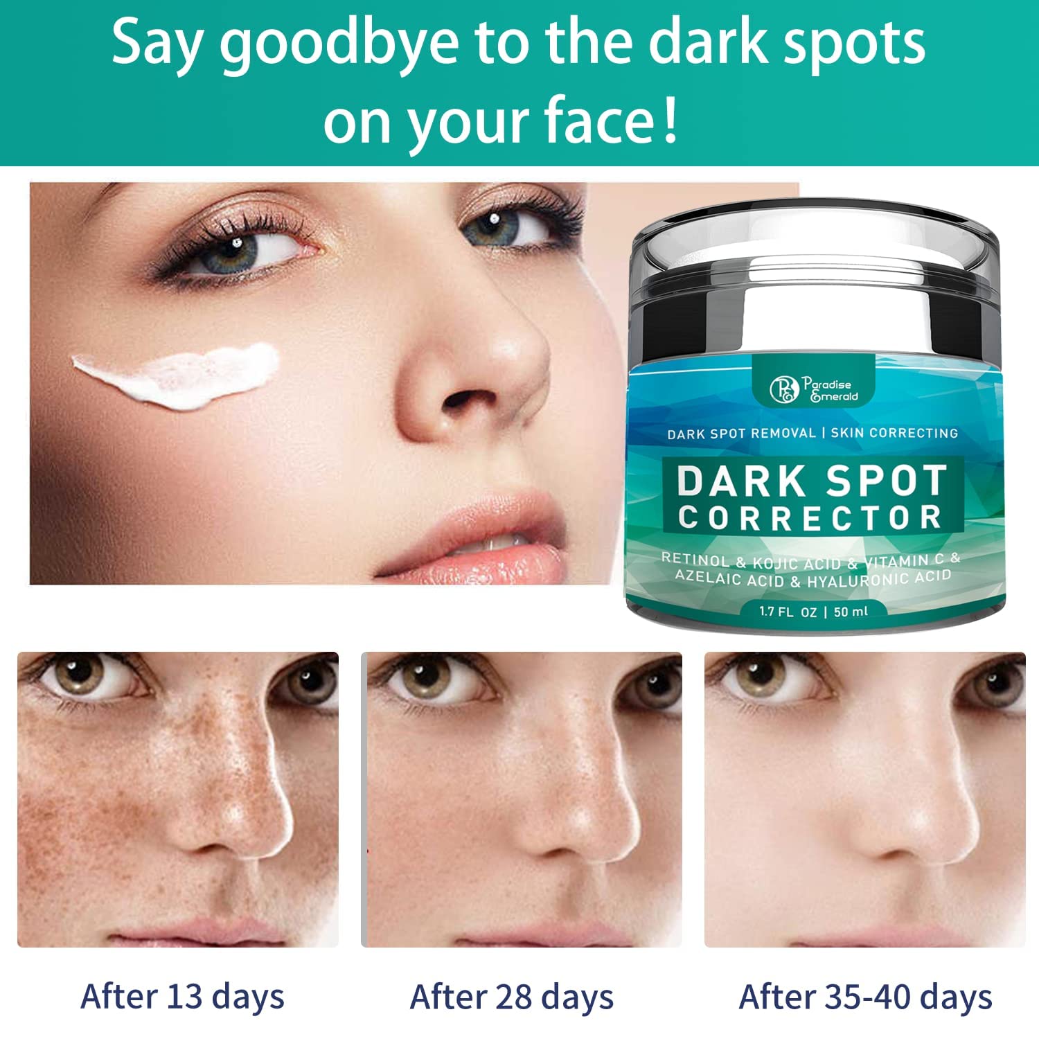 Paradise Emerald Dark Spot Remover for Face – Hyperpigmentation & Sun Spot Treatment for All Skin Types