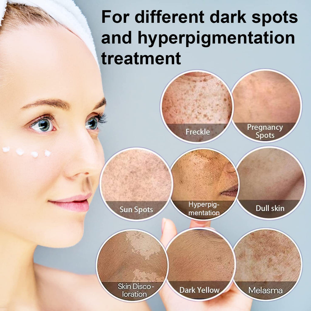 Paradise Emerald Dark Spot Remover for Face – Hyperpigmentation & Sun Spot Treatment for All Skin Types