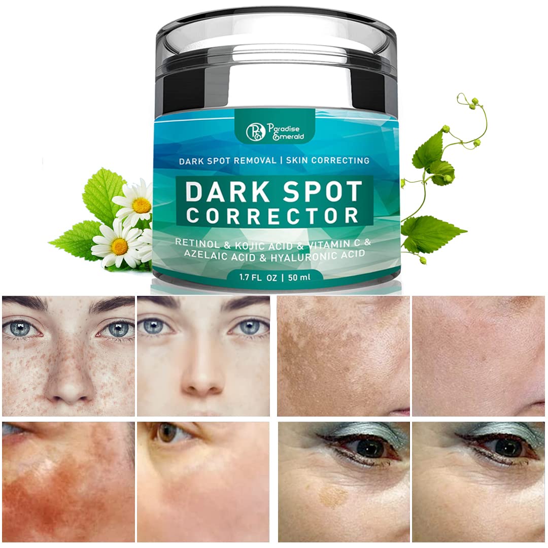 Paradise Emerald Dark Spot Remover for Face – Hyperpigmentation & Sun Spot Treatment for All Skin Types