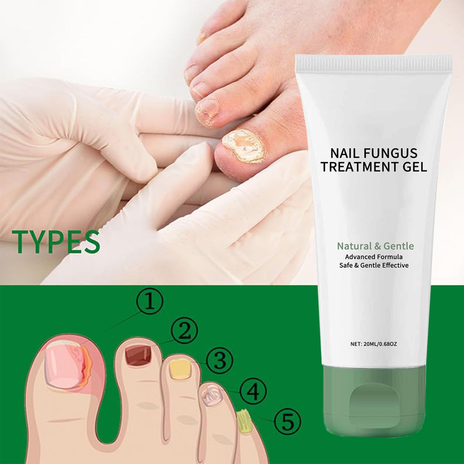 PARWENE Natural Nail Treatment Gel – Nail Growth Serum for Repair & Strengthening (20 ml)
