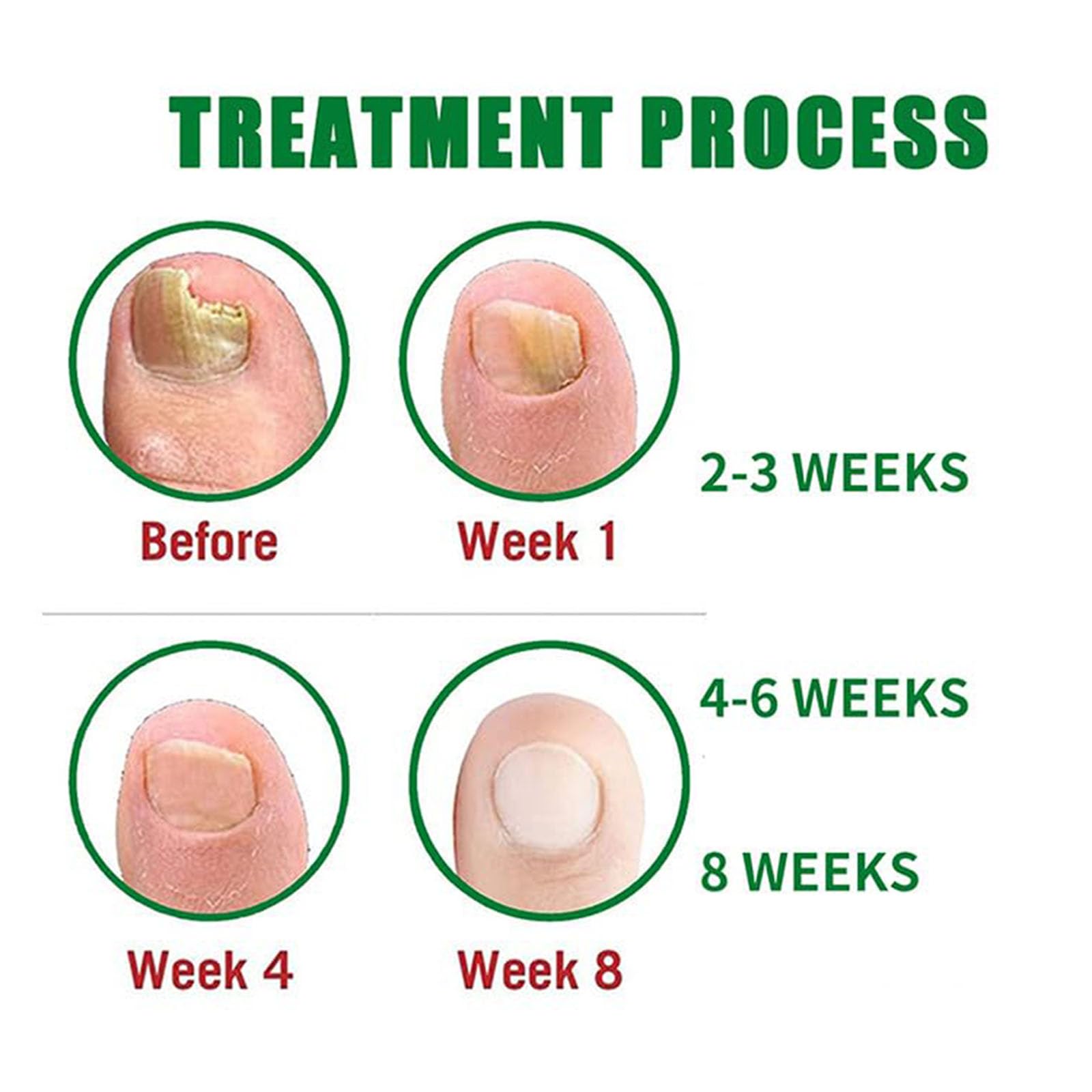PARWENE Natural Nail Treatment Gel – Nail Growth Serum for Repair & Strengthening (20 ml)