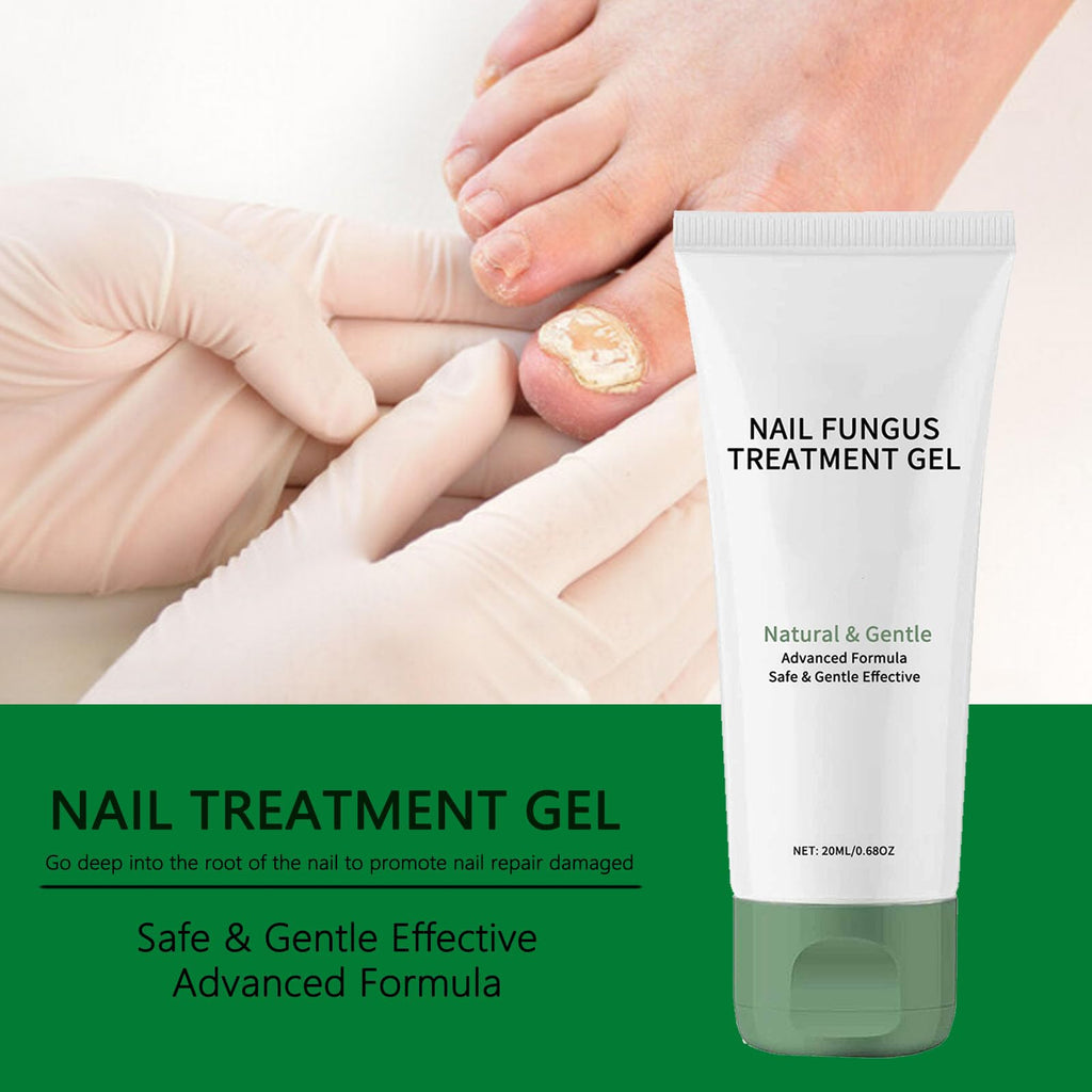 PARWENE Natural Nail Treatment Gel – Nail Growth Serum for Repair & Strengthening (20 ml)