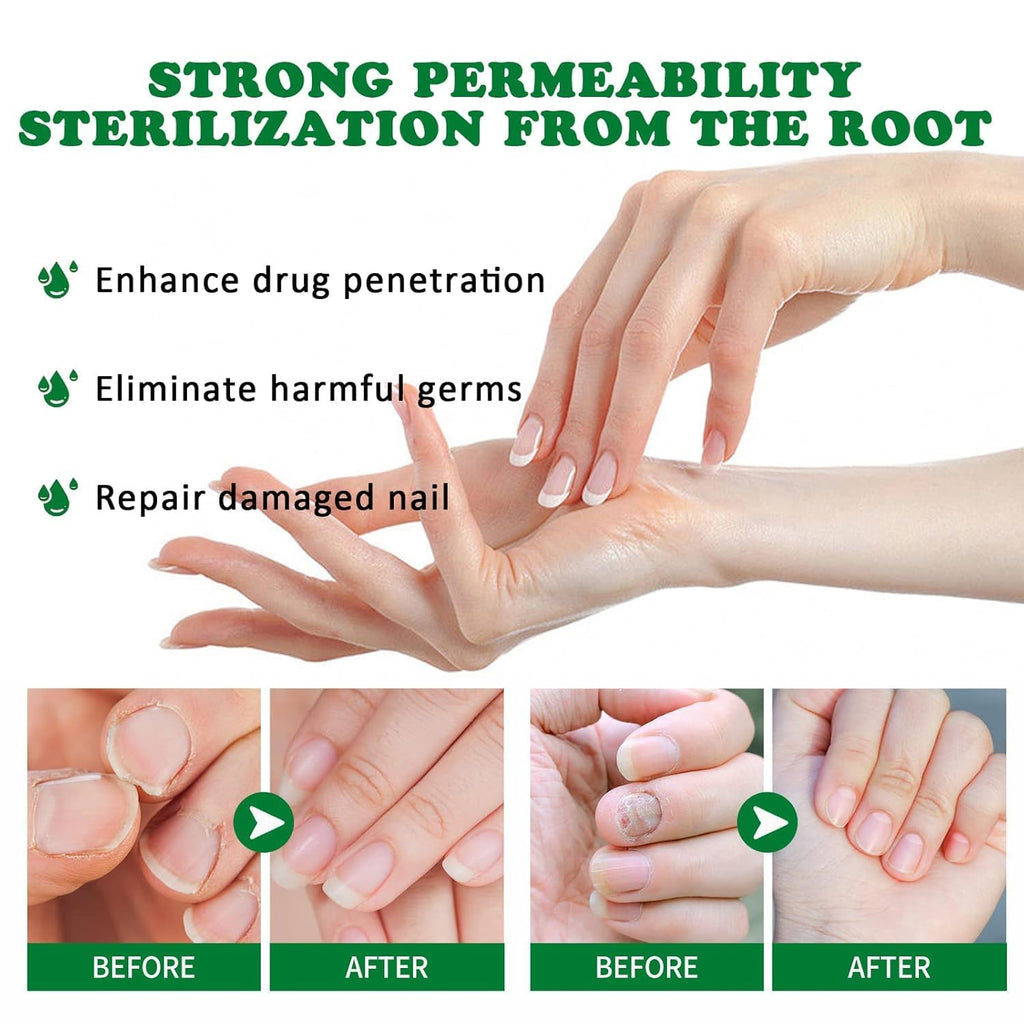 PARWENE Natural Nail Treatment Gel – Nail Growth Serum for Repair & Strengthening (20 ml)