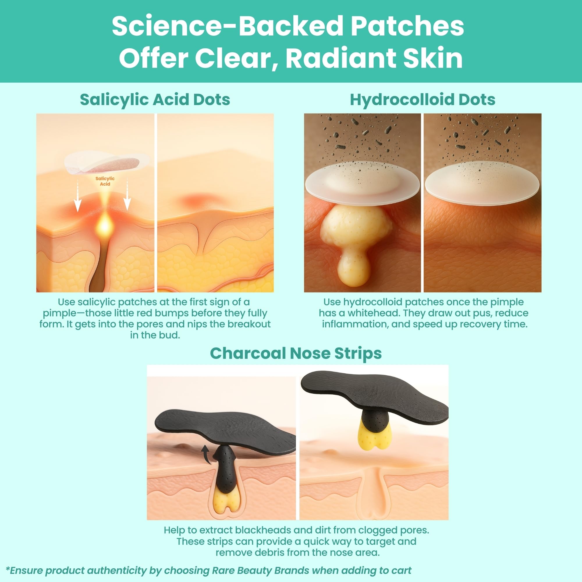 Patchology Breakout Box 3-in-1 Acne Treatment Kit – Nose Strips, Salicylic & Hydrocolloid Dots (2-Pack)