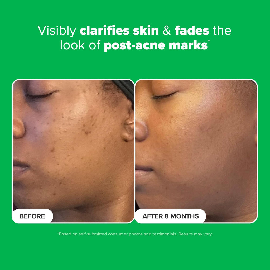 Paula's Choice BOOST 10% Azelaic Acid Booster Cream Gel – Fragrance-Free, Oil-Free Serum (0.17 fl oz)
