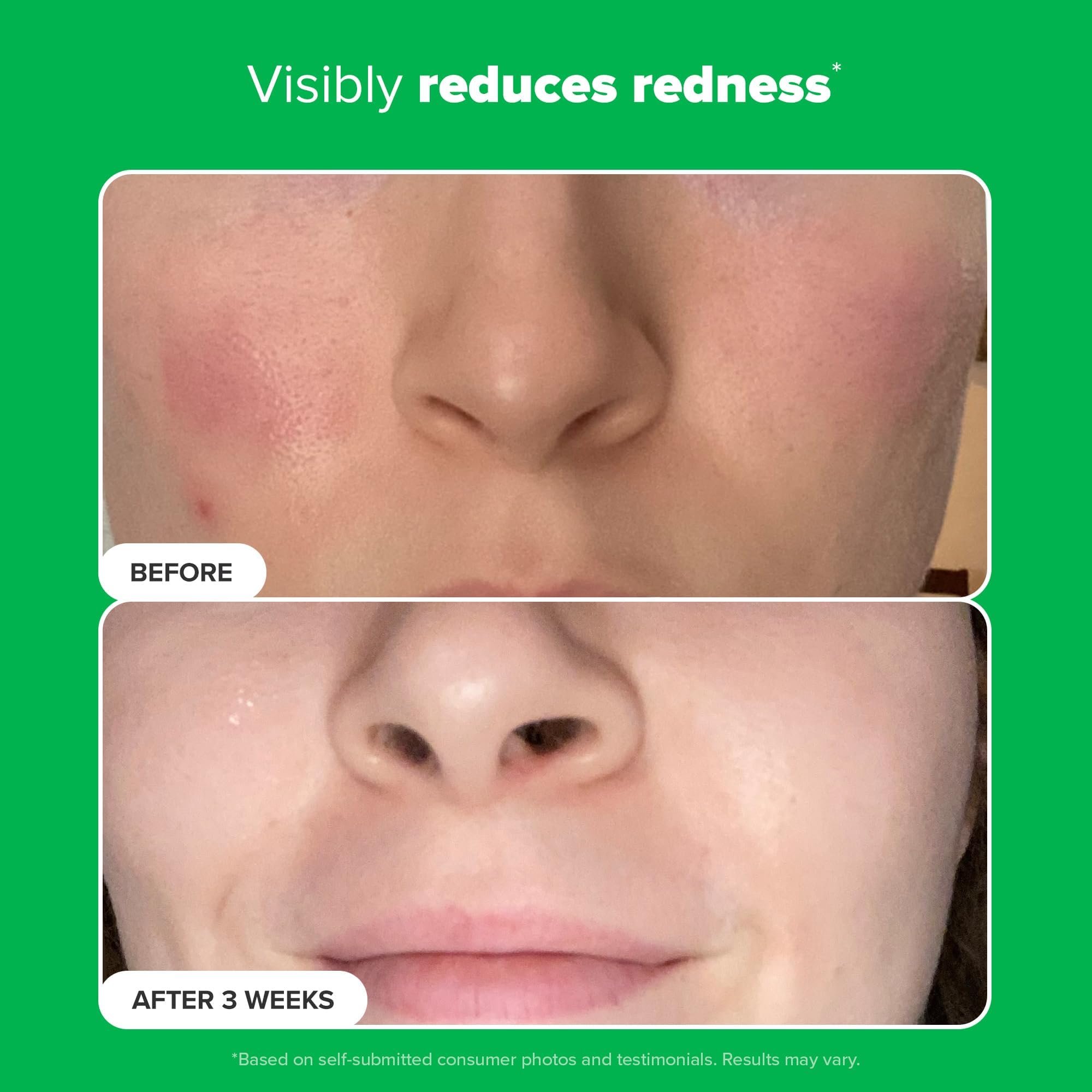 Paula's Choice BOOST 10% Azelaic Acid Booster Cream-Gel – Oil-Free Serum with Salicylic Acid