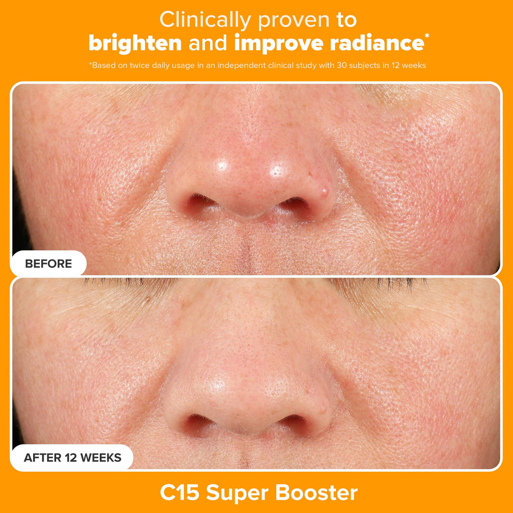 Paula's Choice Brighter Days Ahead Kit – Vitamin C, Mandelic Acid & SPF 50
