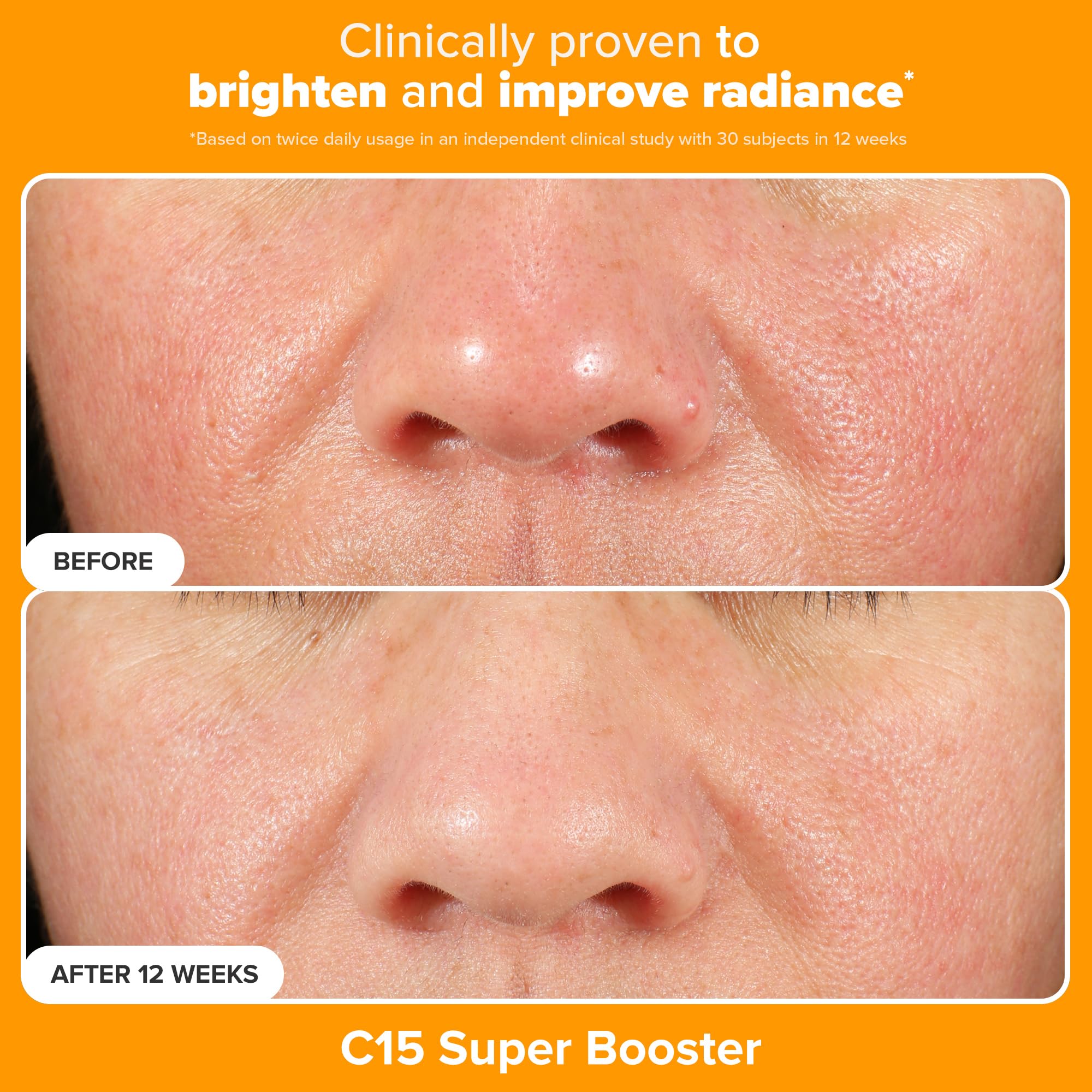 Paula's Choice Brighter Days Ahead Kit – Vitamin C, Mandelic Acid & SPF 50