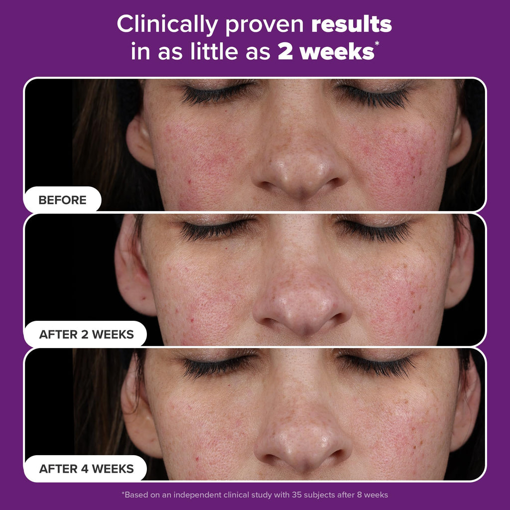 Paula’s Choice Pro Retinaldehyde Dual-Retinoid Serum — High Potency Anti-Aging for Breakout-Prone Skin