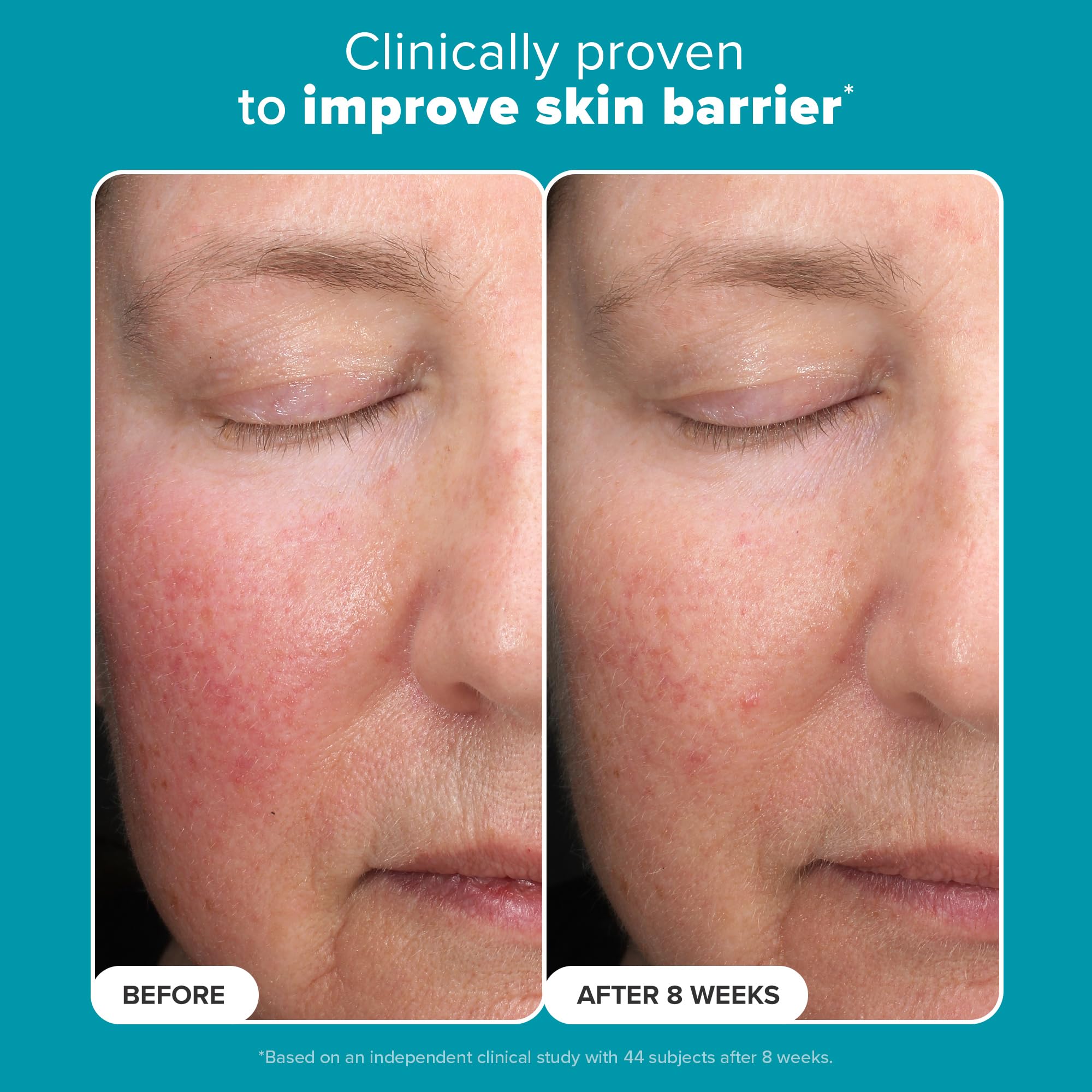 Paula’s Choice 6% Mandelic + 2% Lactic Acid Exfoliant – Gentle Daily AHA for Discoloration & Texture (Fragrance-Free) 3 fl oz