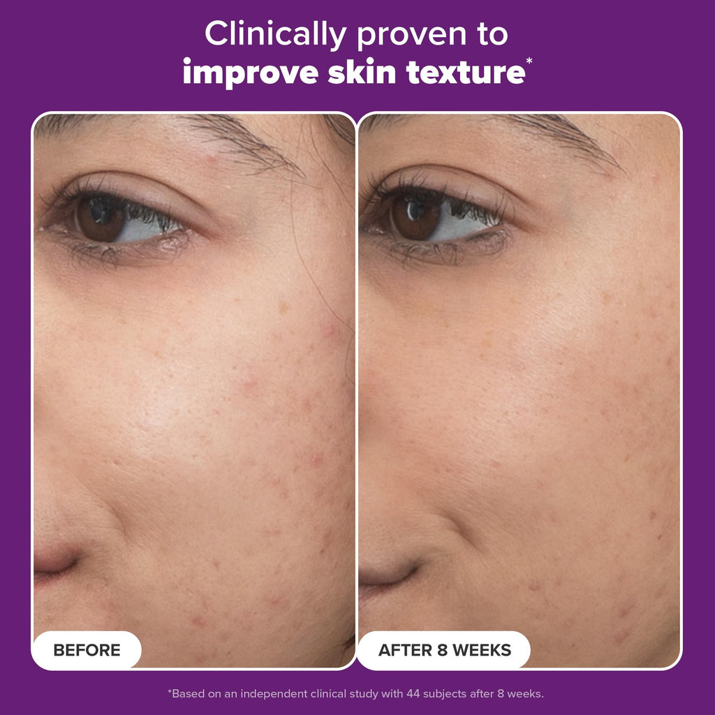 Paula’s Choice Pro Retinaldehyde Dual-Retinoid Serum — High Potency Anti-Aging for Breakout-Prone Skin