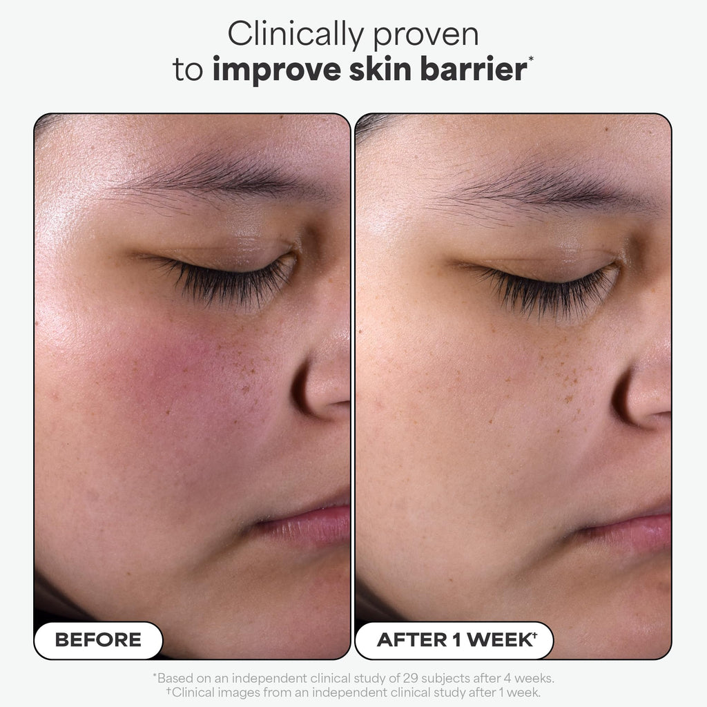 Paula's Choice SKIN PERFECTING 2% BHA Liquid Exfoliant – Unclog Pores, Smooth Fine Lines, Fragrance-Free