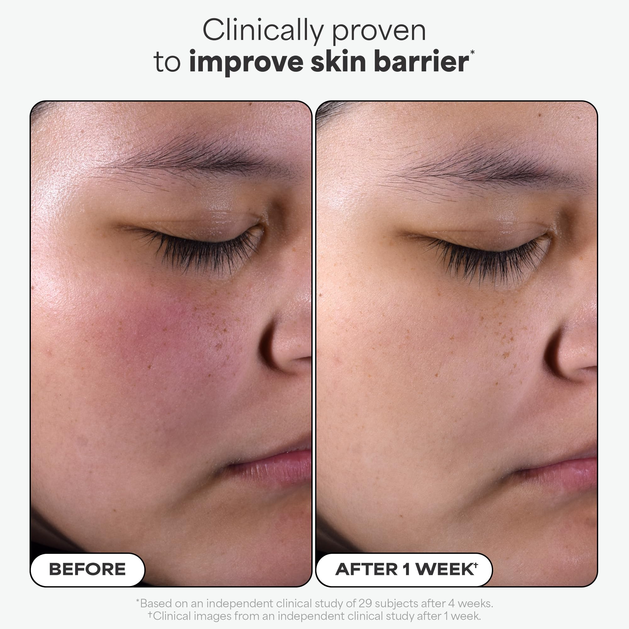 Paula's Choice SKIN PERFECTING 2% BHA Liquid Exfoliant – Unclog Pores, Smooth Fine Lines, Fragrance-Free