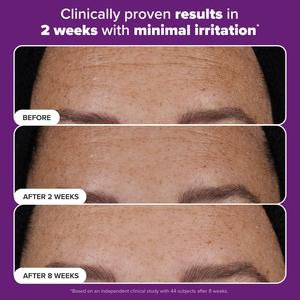 Paula’s Choice Pro Retinaldehyde Dual-Retinoid Serum — High Potency Anti-Aging for Breakout-Prone Skin