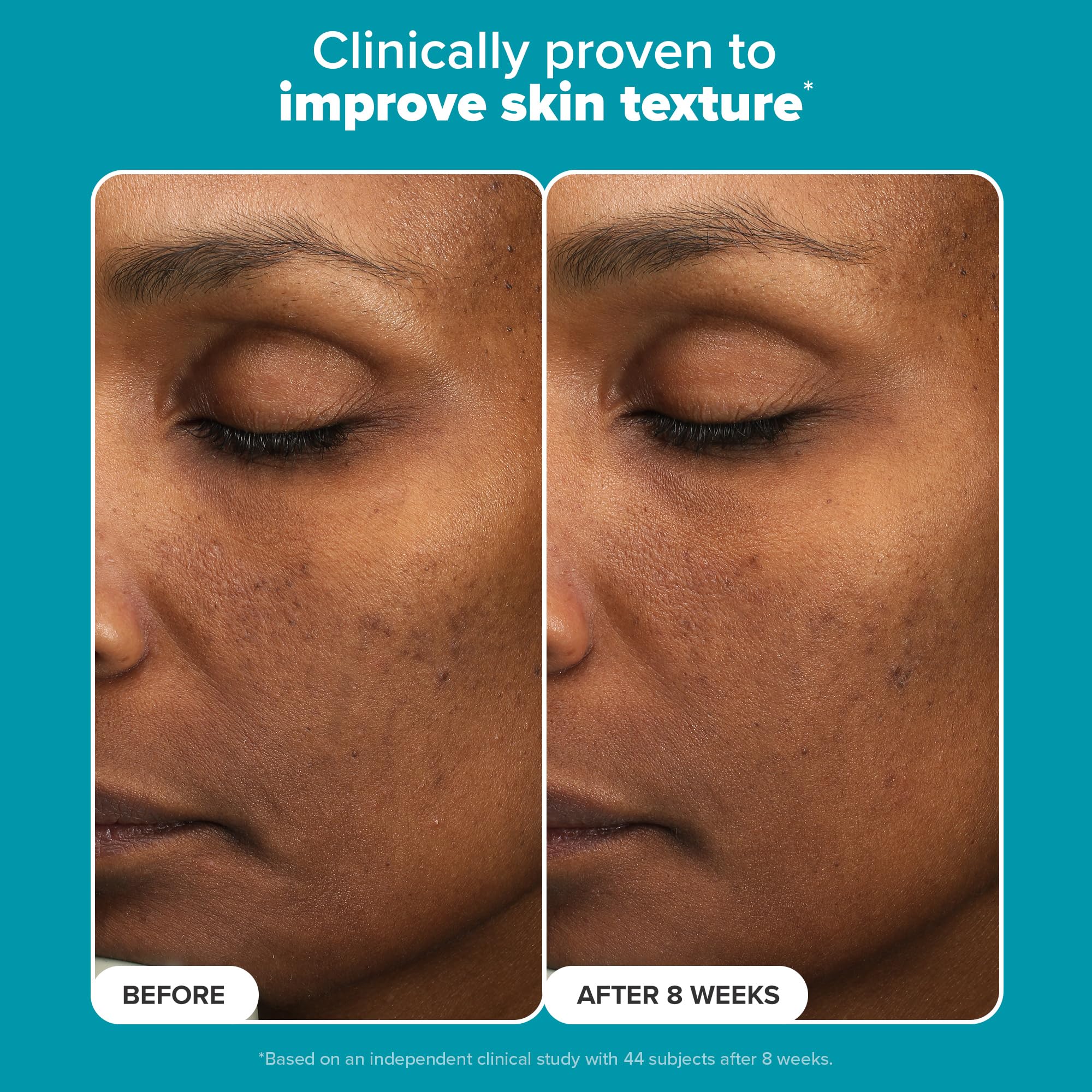 Paula’s Choice 6% Mandelic + 2% Lactic Acid Exfoliant – Gentle Daily AHA for Discoloration & Texture (Fragrance-Free) 3 fl oz