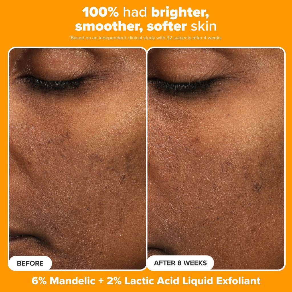 Paula's Choice Brighter Days Ahead Kit – Vitamin C, Mandelic Acid & SPF 50