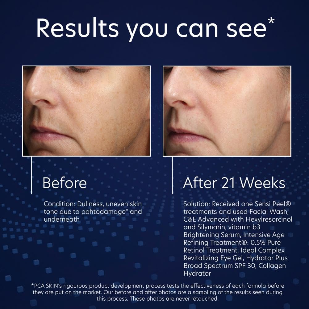 PCA SKIN Vitamin B3 Brightening Serum – Dark Spot Corrector & Hydrating Niacinamide