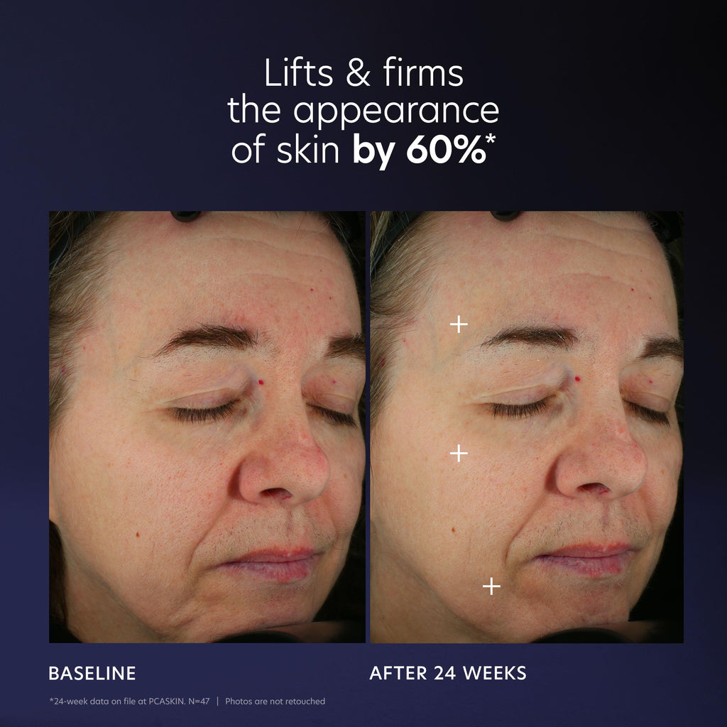 PCA SKIN Pro Max Age Renewal Anti Aging Serum – Lift, Firm & Plump Skin on Face & Neck | 1 oz Pump