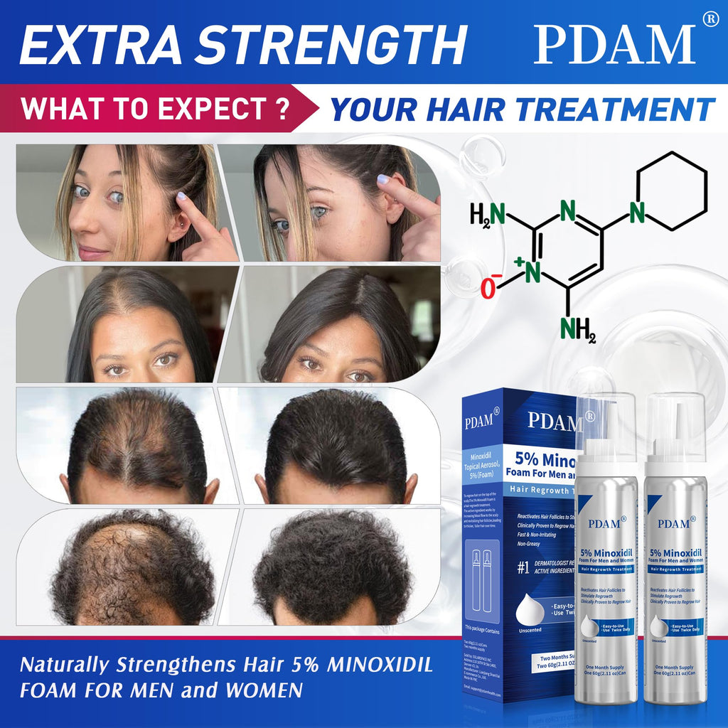 Pdam 5% Minoxidil Foam for Men & Women – Hair Growth Treatment (2 x 2.11 oz)