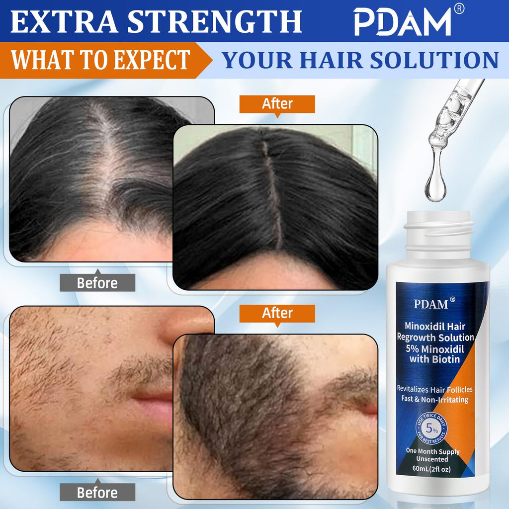 Pdam Minoxidil 5% Hair Growth Serum for Men & Women – 6 oz