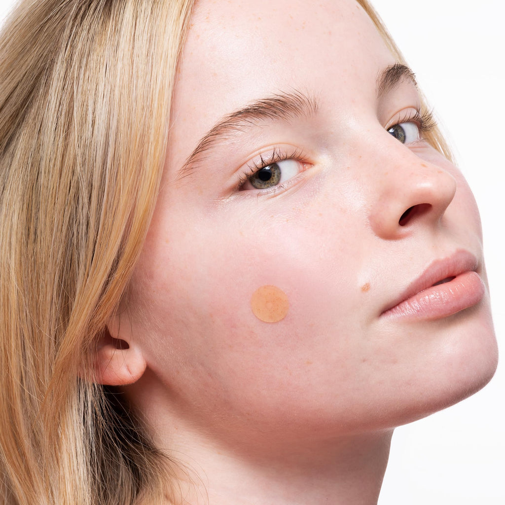Peace Out Acne Healing Dots – Fast-Acting Pimple Patches with Salicylic Acid & Retinol (20 Count)