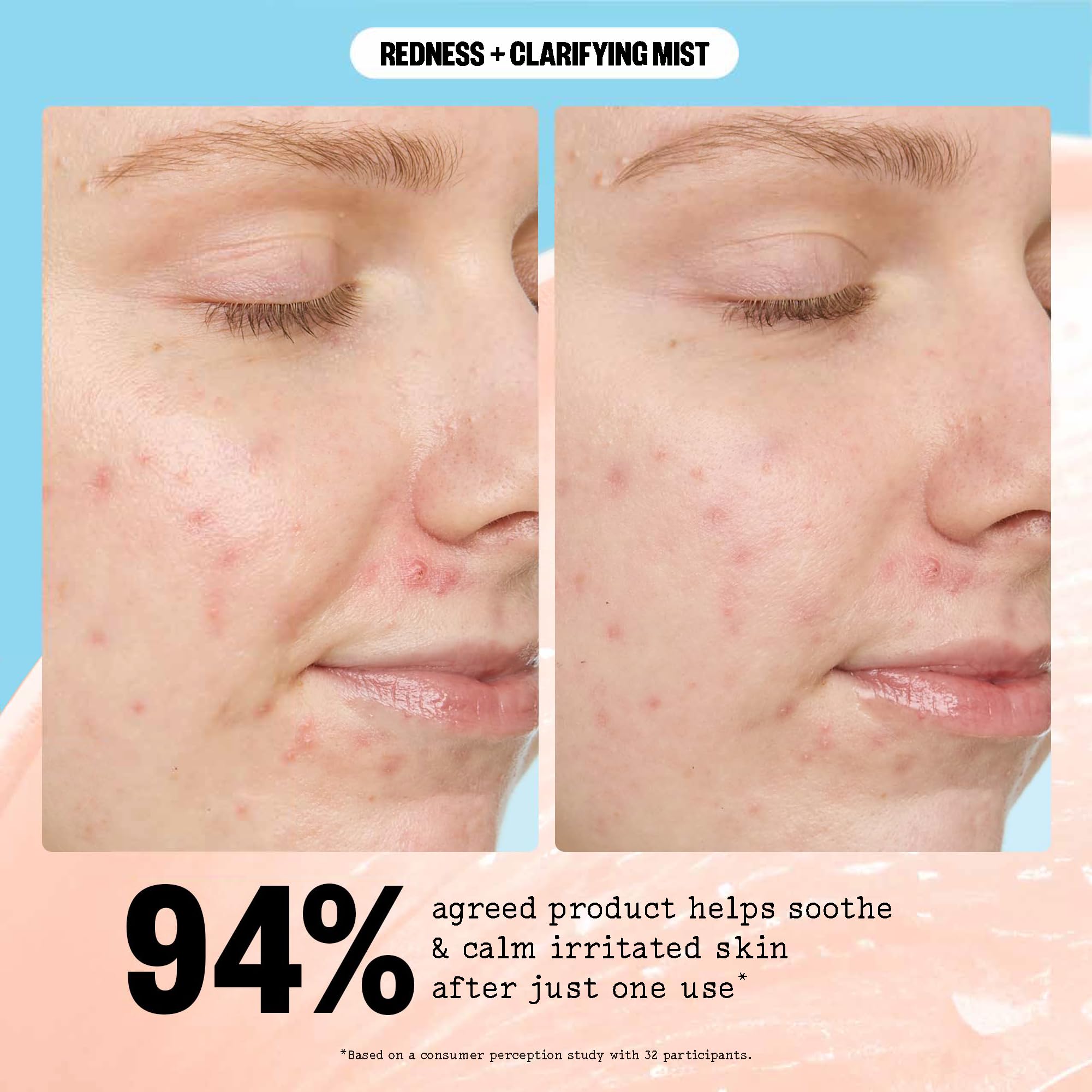 PEACE OUT Redness + Clarifying Mist — Hypochlorous Facial Spray for Acne-Prone Skin