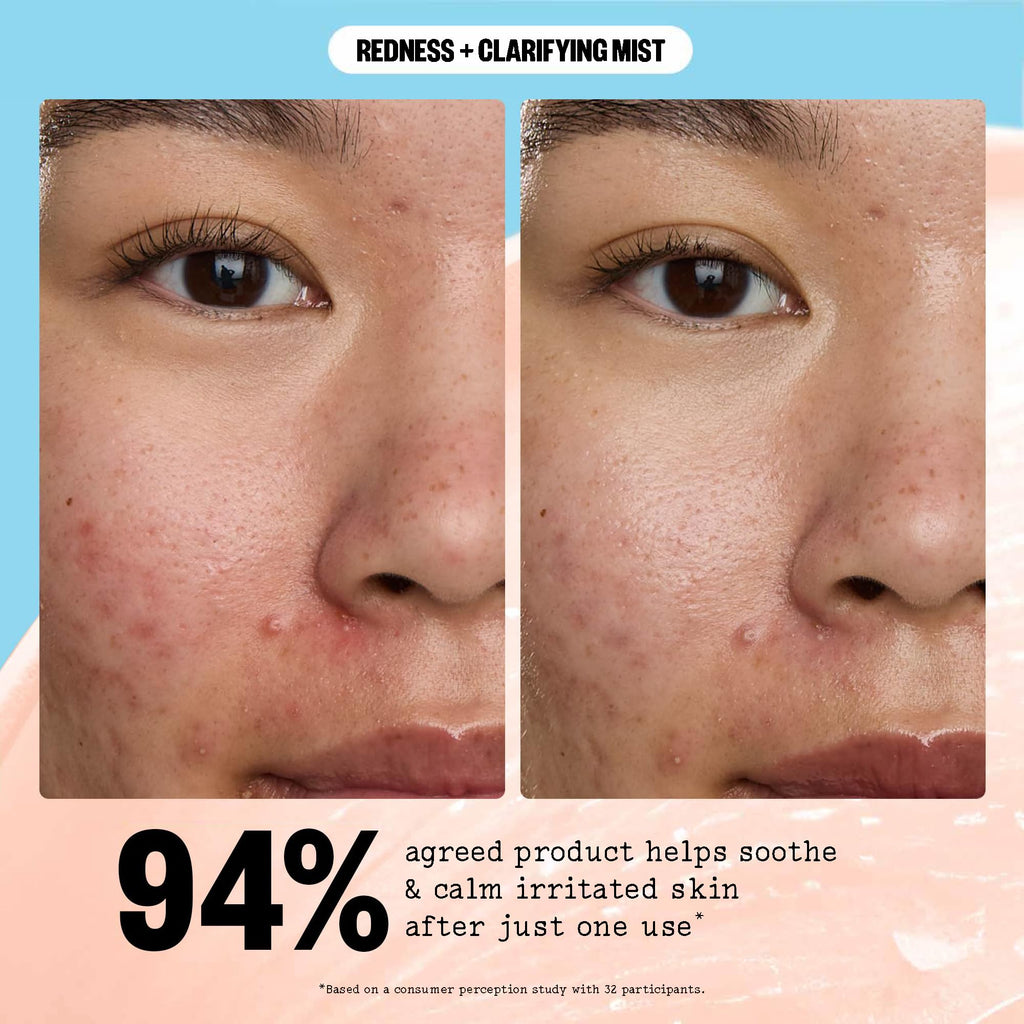 PEACE OUT Redness + Clarifying Mist — Hypochlorous Facial Spray for Acne-Prone Skin