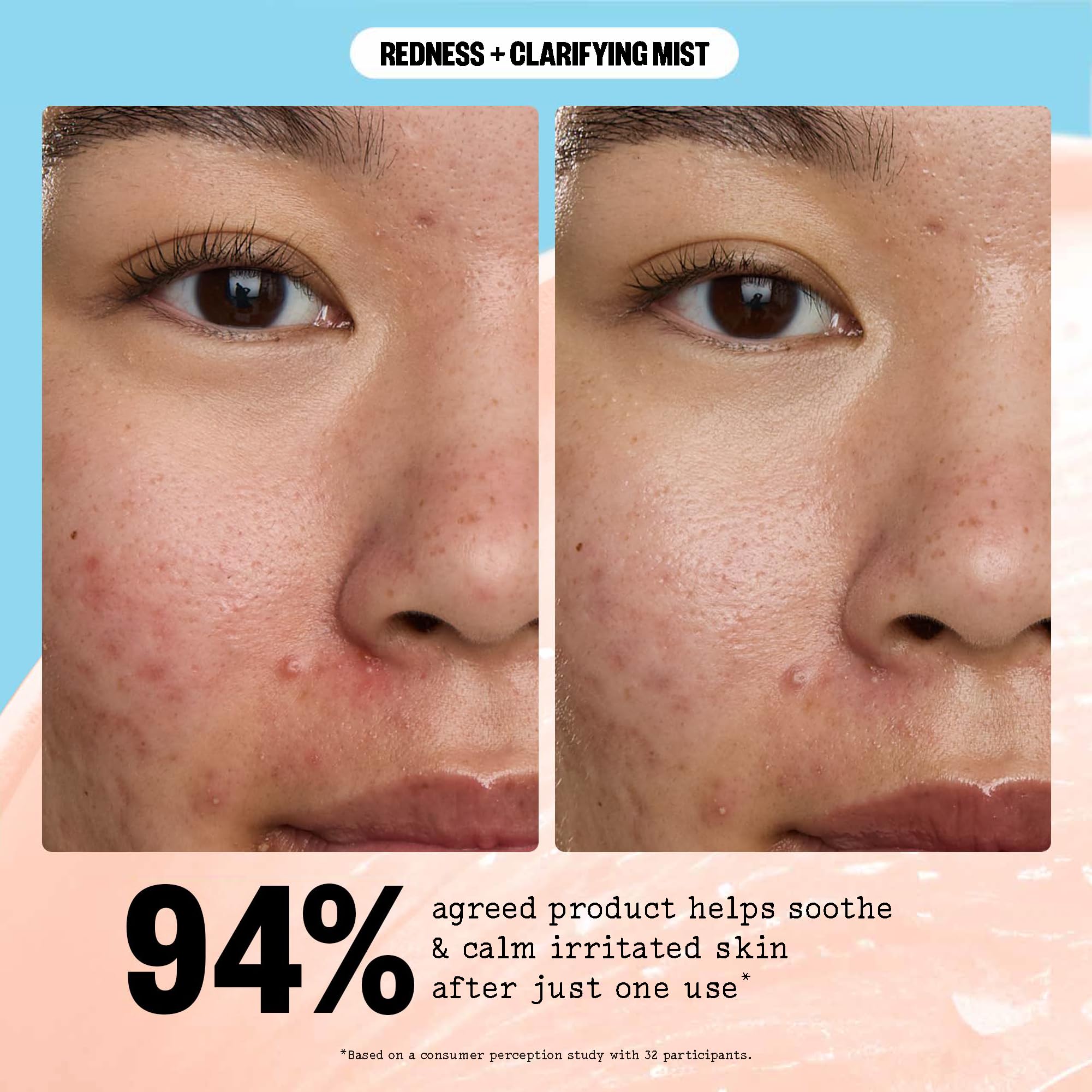 PEACE OUT Redness + Clarifying Mist — Hypochlorous Facial Spray for Acne-Prone Skin