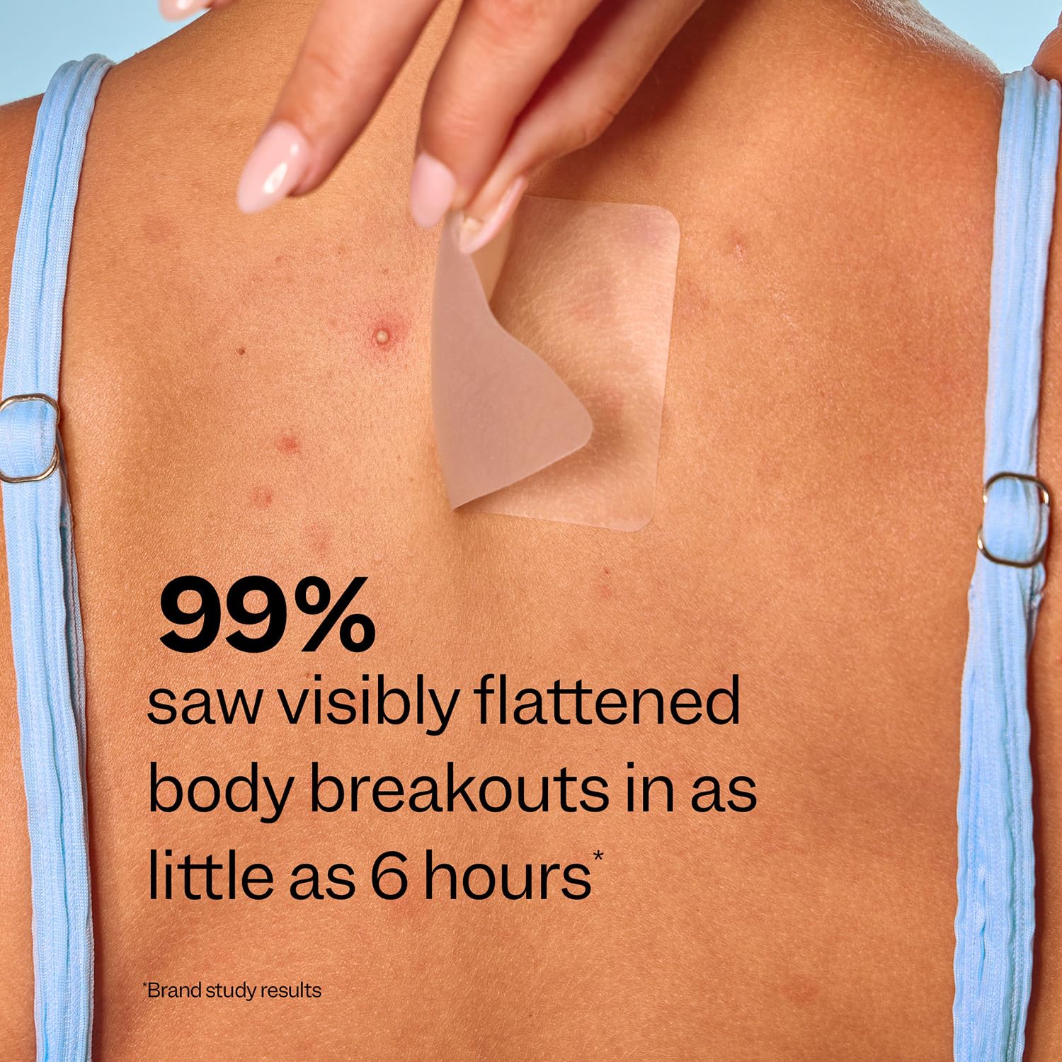 Peach Slices Body Breakout Patches (6 ct) – Overnight Hydrocolloid Patch with Cica, Hypoallergenic & Cruelty-Free