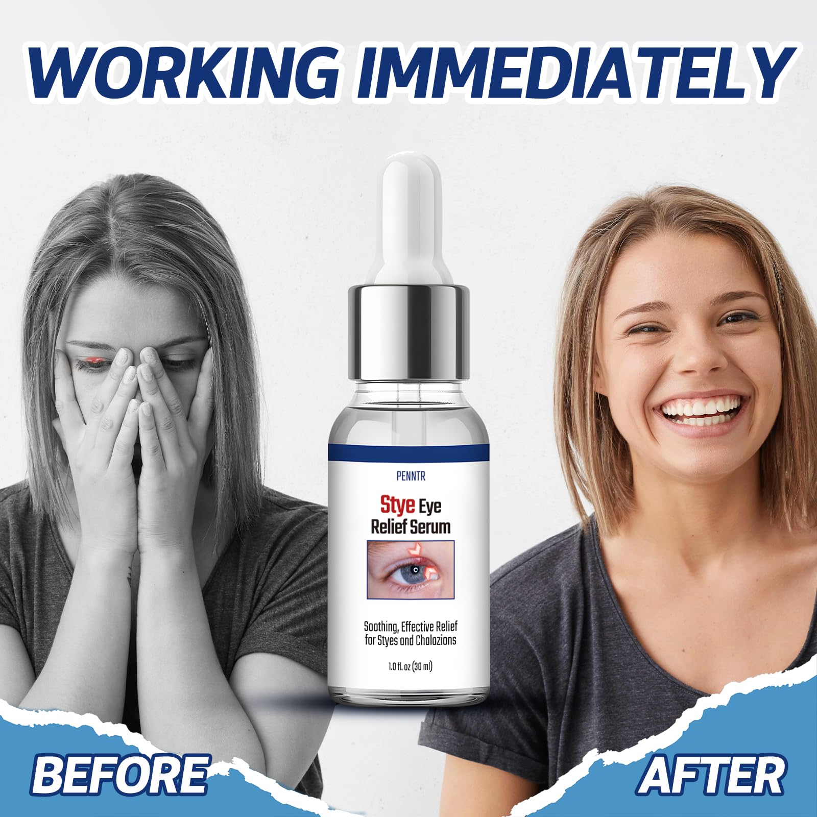 PENNTR Stye Eye Treatment Serum for Chalazion & Blepharitis – Sea Buckthorn, Helichrysum, Avocado Oil (1 Fl Oz)