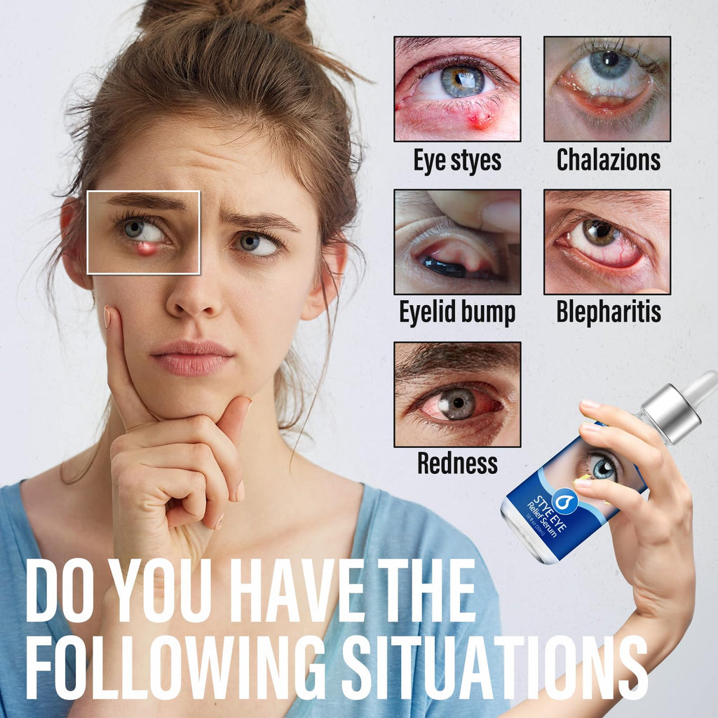 PENNTR Stye Eye Drops - Target Chalazions & Blepharitis, Non-Irritating Eye Treatment with Hippophae Rhamnoides & Avocado Oil (1 Fl. Oz)