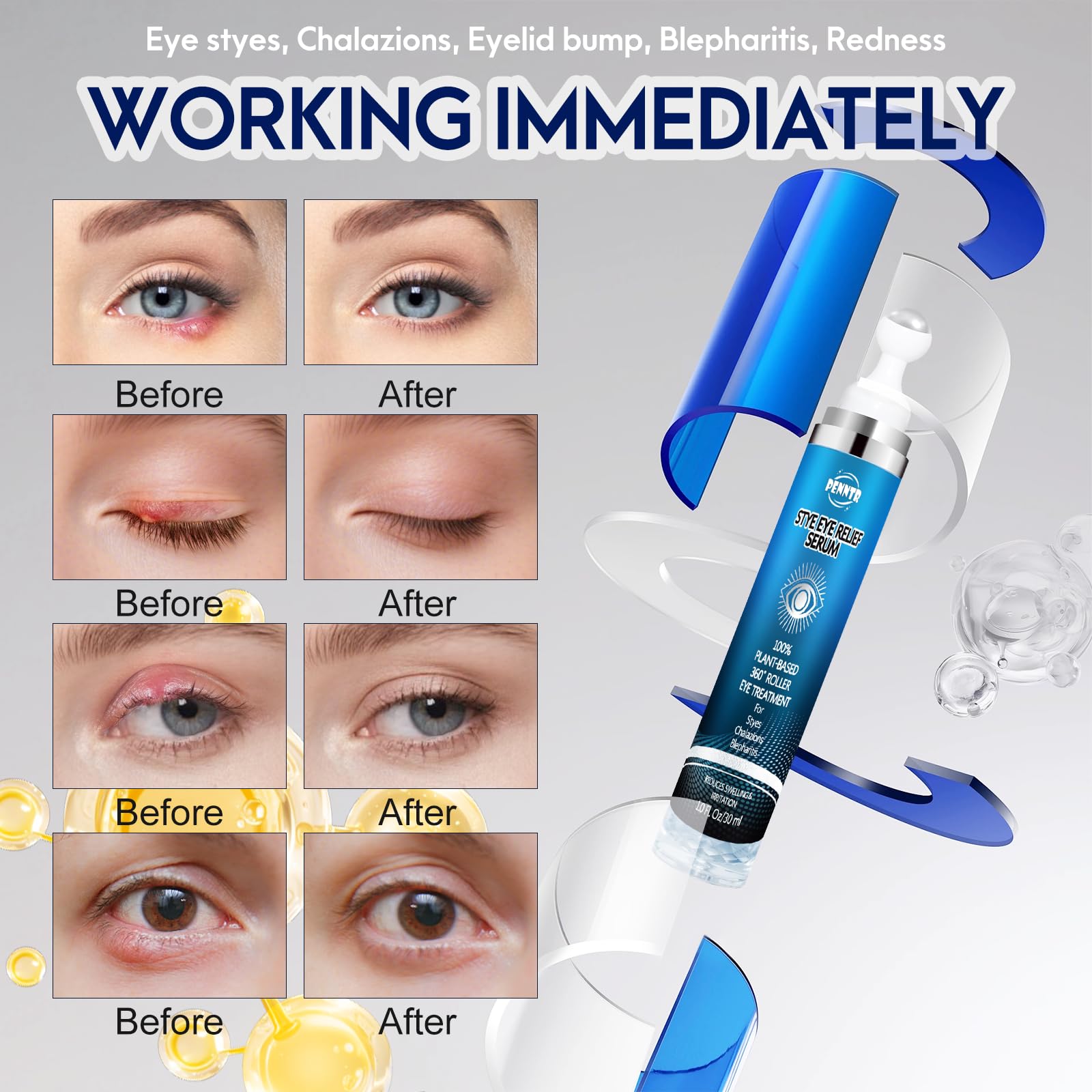 PENNTR Stye Eye Treatment – 360° Rollerball Eye Serum for Eyelid Comfort