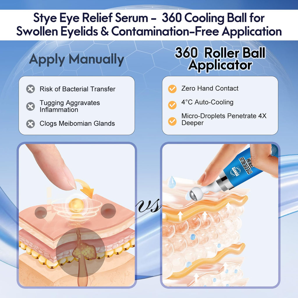 PENNTR Stye Eye Treatment – 360° Rollerball Eye Serum for Eyelid Comfort