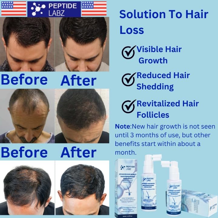 PeptideLabz Hair Growth Serum Spray – Acetyl Tetrapeptide-3, Biotinoyl Tripeptide-1, Caffeine, Licorice Root Extract