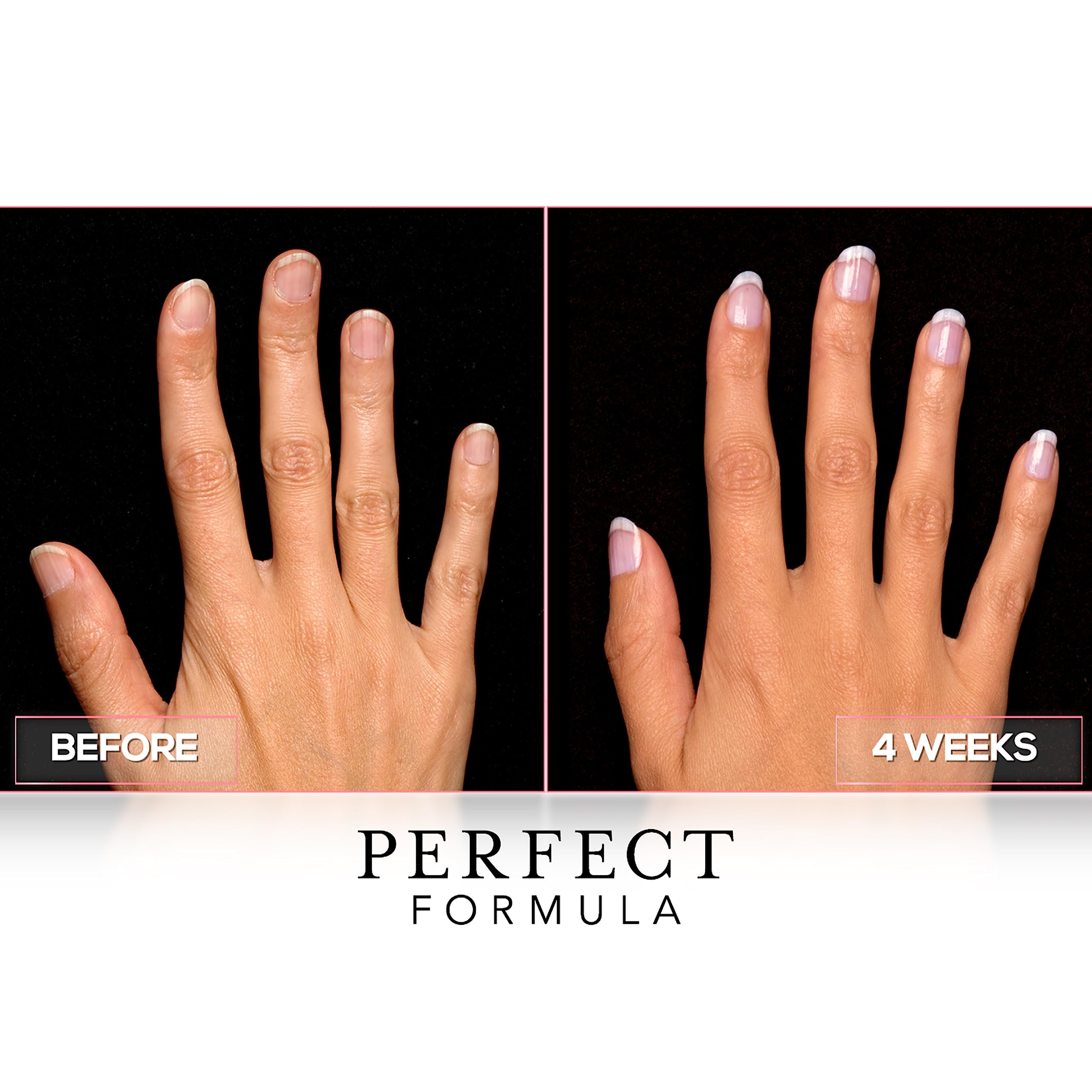 Perfect Formula Gel Coat Manicure Set – Nail Strengthener with Keratin (4 x 0.17 Fl oz) – Made in USA