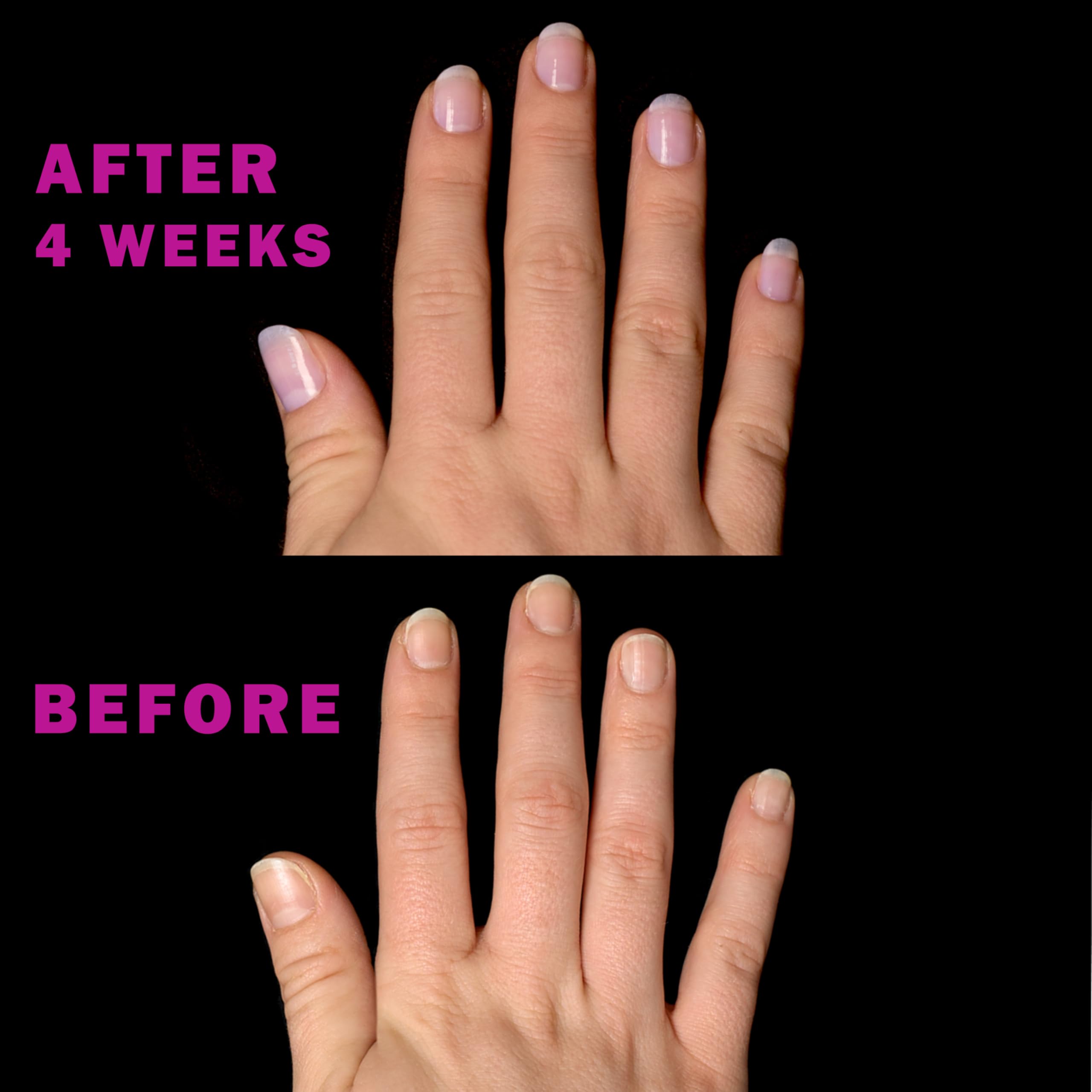 Perfect Formula Nail Essentials Kit – 4-Piece Keratin Nail Strengthener & Growth