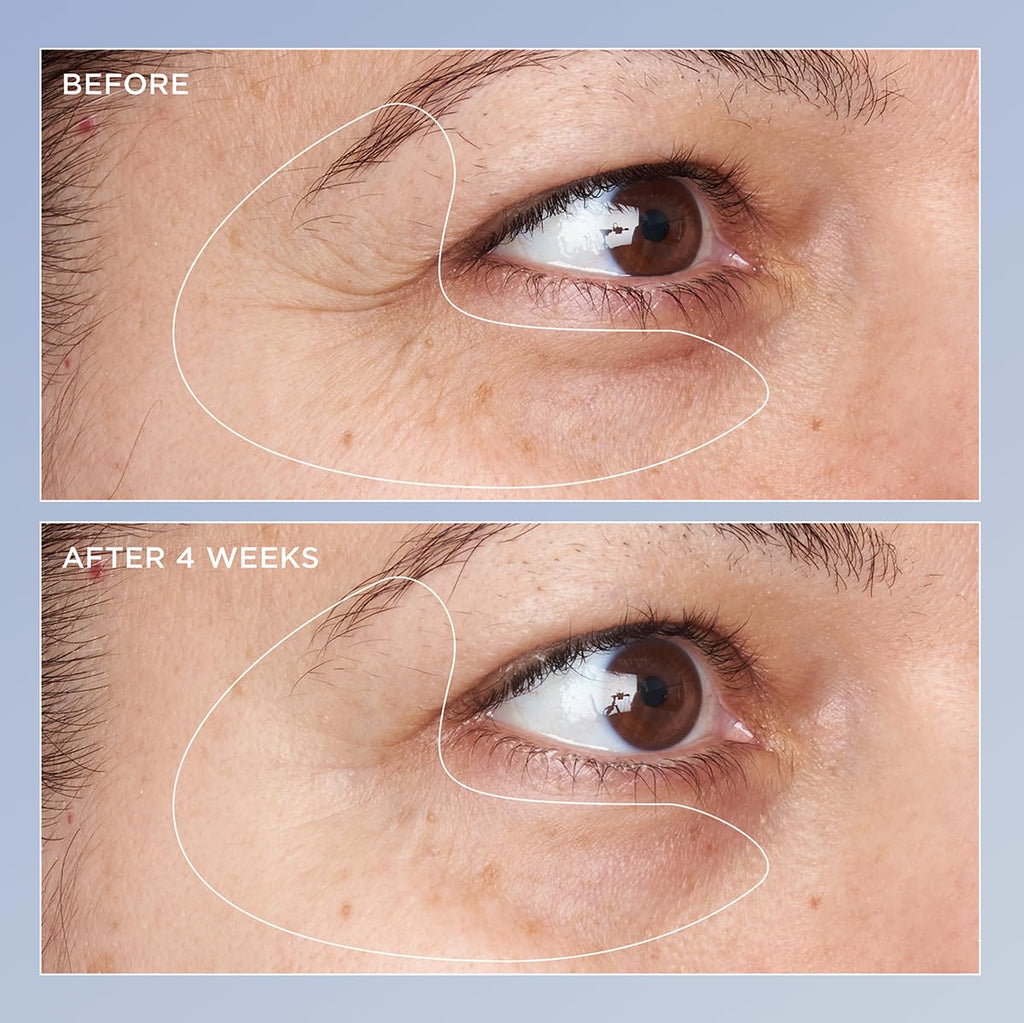 Perricone MD High Potency Triple Retinol Renewal Eye Serum – 0.5 fl oz