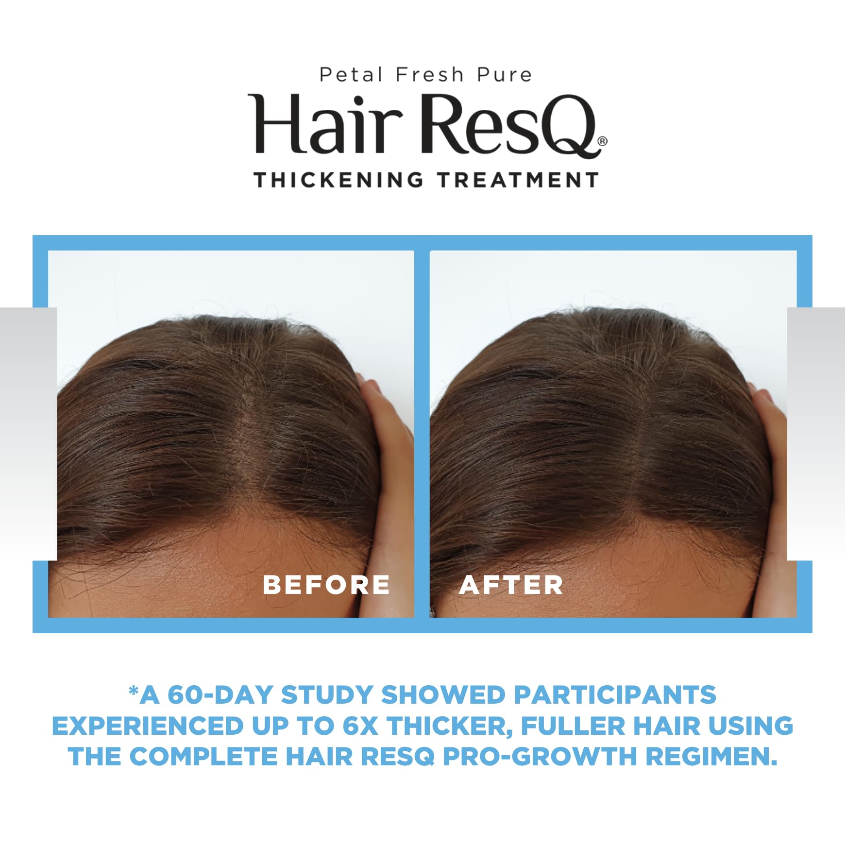 Petal Fresh Hair ResQ Biotin Thickening Spray | Volumizing for Thinning Hair