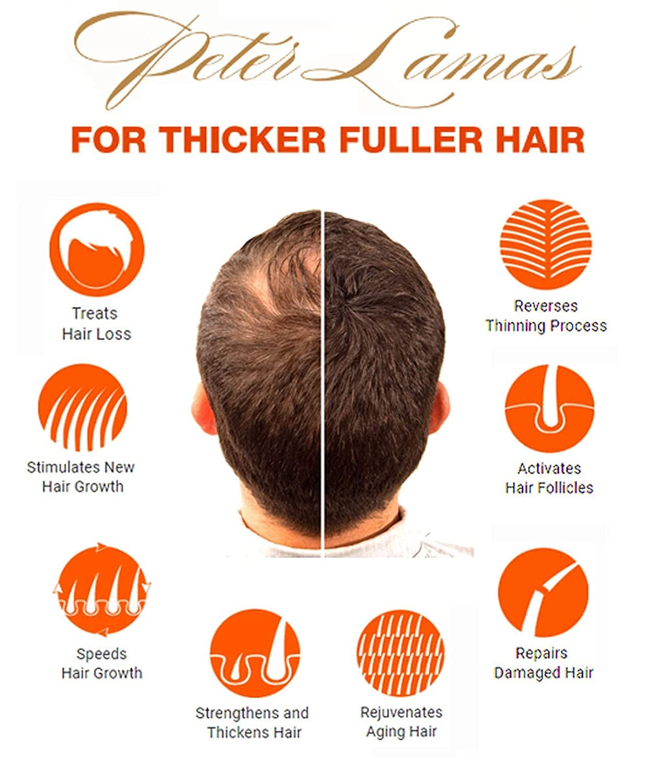 Peter Lamas Biotin Shampoo for Men & Women — DHT Blocker, Thicker, Fuller Hair
