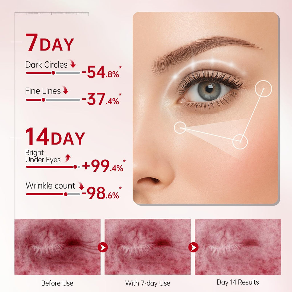 Peunitory Eye Balm Stick – Hydrating Under Eye Cream, Anti-Wrinkle & Brightening (0.32oz)