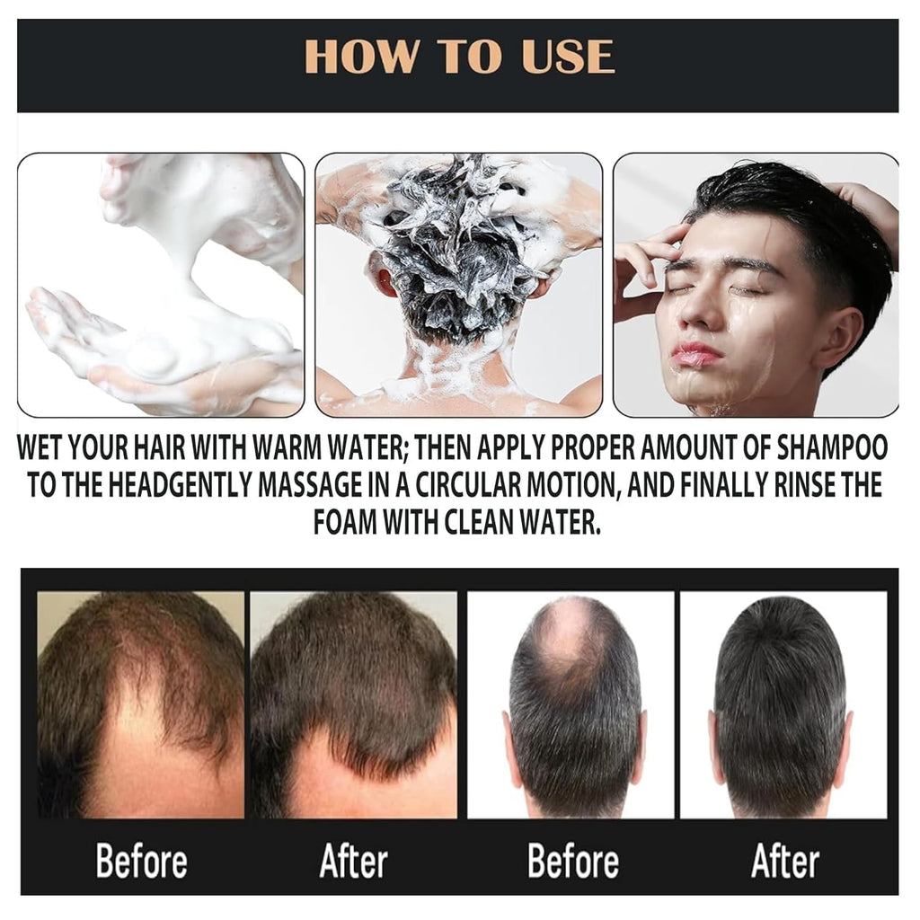 PEWATUL SPARSTAN Root Activator Shampoo – Anti Hair Loss, Natural Regrowth Formula, Thickening & Nourishing | 1pc